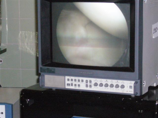 Travel - Bolivia - Knee Operation
